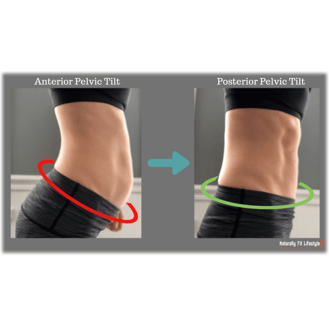 Diastasis Recti: What Is It And What To Do About It ⋆ Naturally