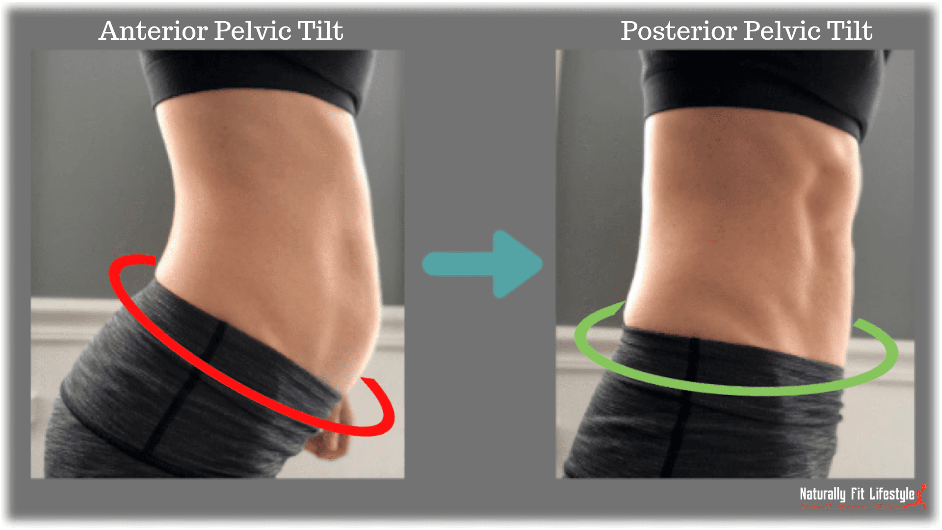 anterior pelvic tilt vrs. posterior pelvic tilt